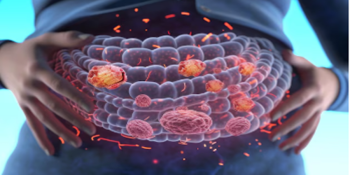 Jovens em Risco: Como a Alimentação Pode Influenciar o Câncer Colorretal